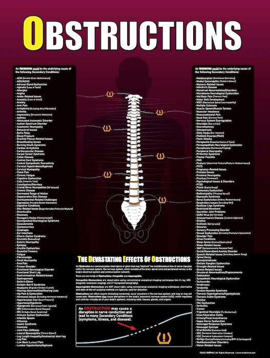 Obstructions Poster EXTERNAL Window Adhesive