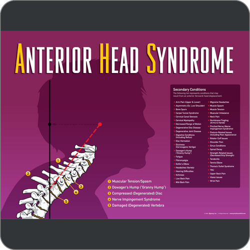 Anterior Head Syndrome Poster