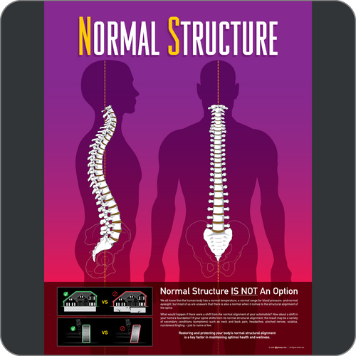 Normal Structure HDHM Window Graphic