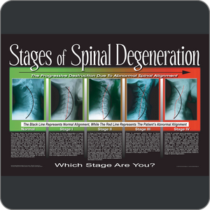 Stages of Spinal Degeneration